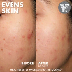 Yo Glow Enzyme Scrub 10 Yo Glow Enzyme Scrub -GlowAura Store YOGLOWREPROMOTEPDPEVENSSKIN