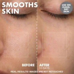 Yo Glow Enzyme Scrub 12 Yo Glow Enzyme Scrub -GlowAura Store YOGLOWREPROMOTEPDPSMOOTHSSKIN