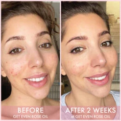 Get Even Rose Oil -GlowAura Store chloe ba